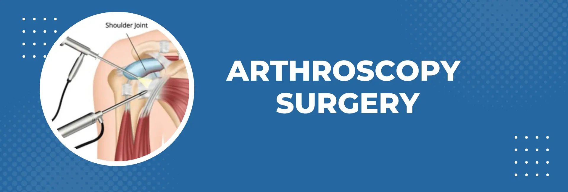 arthroscopy surgery in delhi
