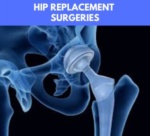 hip replacement surgery in delhi