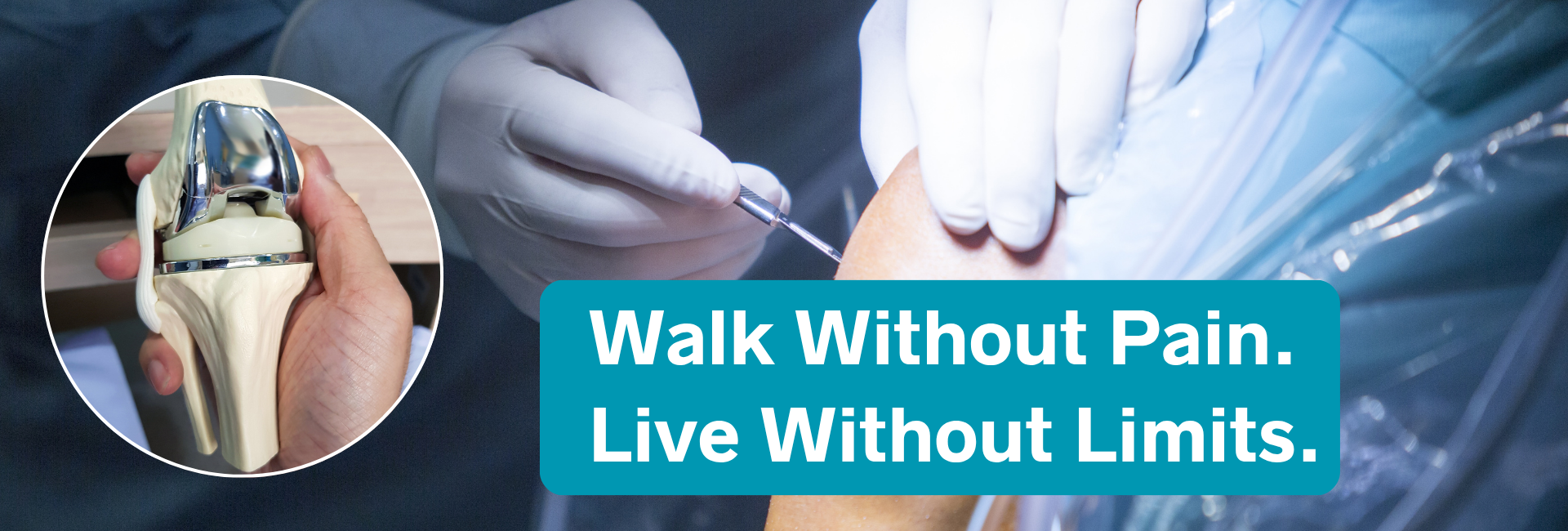 knee replacement surgery in Delhi